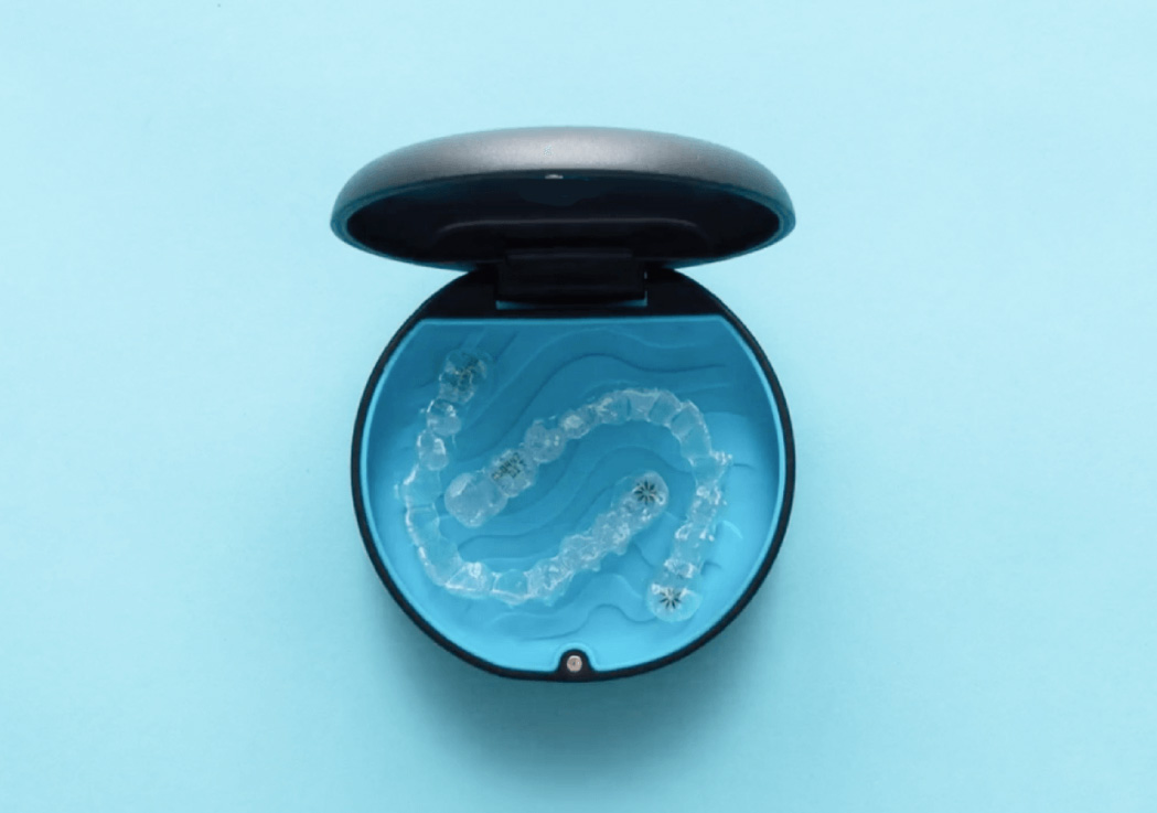 aligners in bangalore