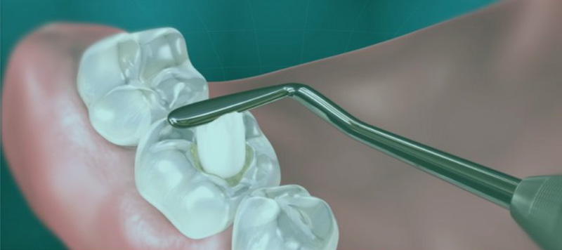 General Dental Checkup