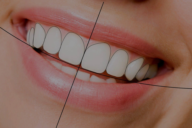 Digital Smile Design